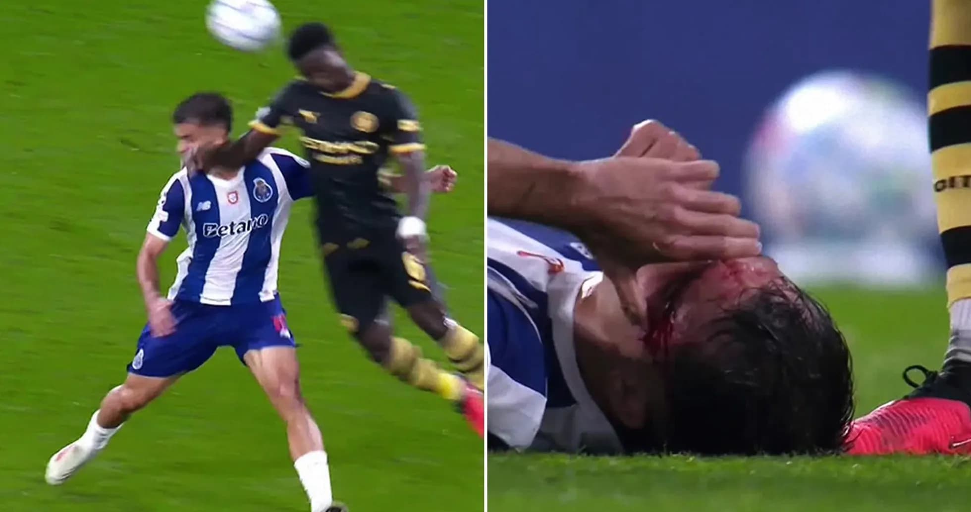 Joueur de Porto blessé après un choc avec adversaire