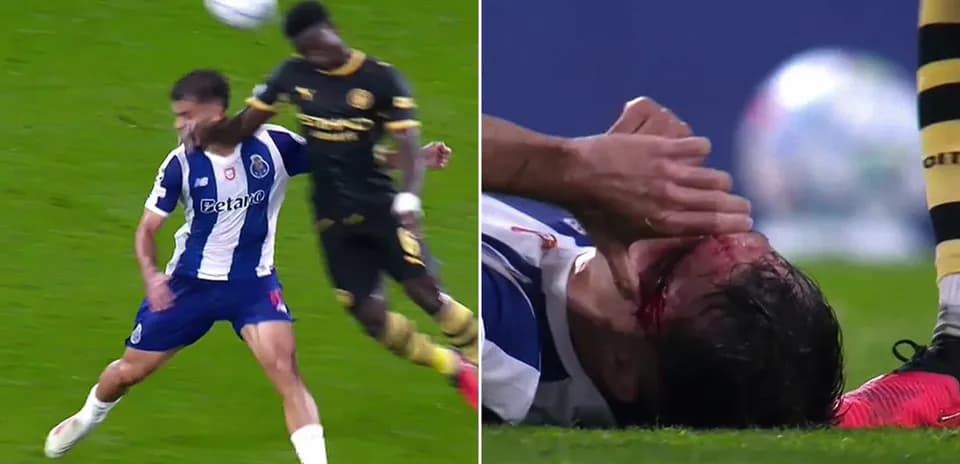 Joueur de Porto blessé après un choc avec adversaire
